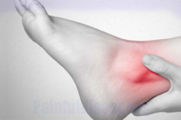 Ankle Pain At Night – Causes and Treatment - Painful Diseases