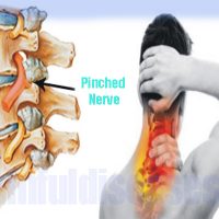 Chest Pain - Painful Diseases