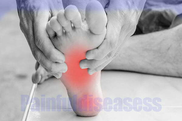 Foot Arch Pain Causes