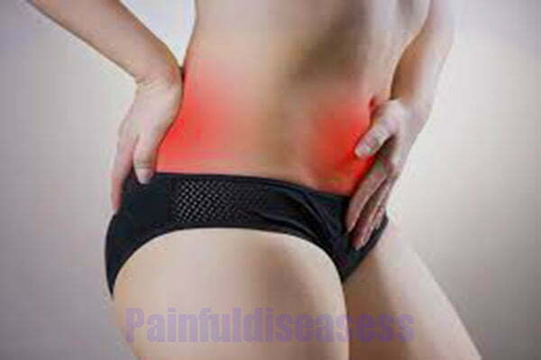 Back Pain Radiating To Groin