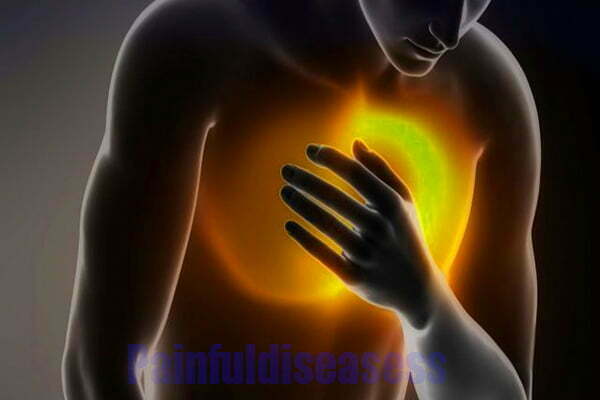 chest-pain-after-throwing-up-painful-diseases