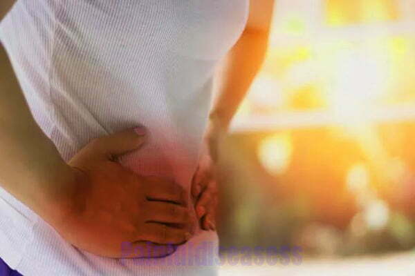 Ovarian Cyst Back Pain