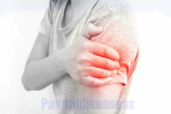 pain-down-right-arm-cause-and-measures-painful-diseases